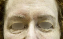 Exilis Ultra