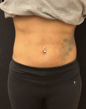 BodyFX