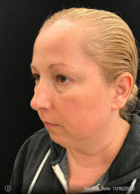 Medispa/Nonsurgical