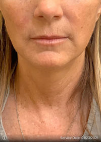 Medispa/Nonsurgical