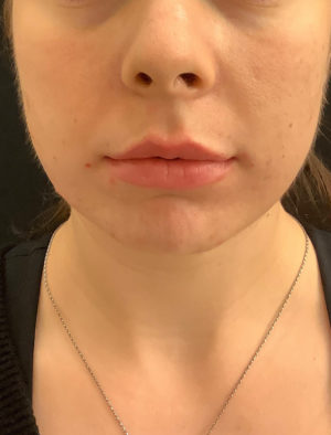 Medispa/Nonsurgical