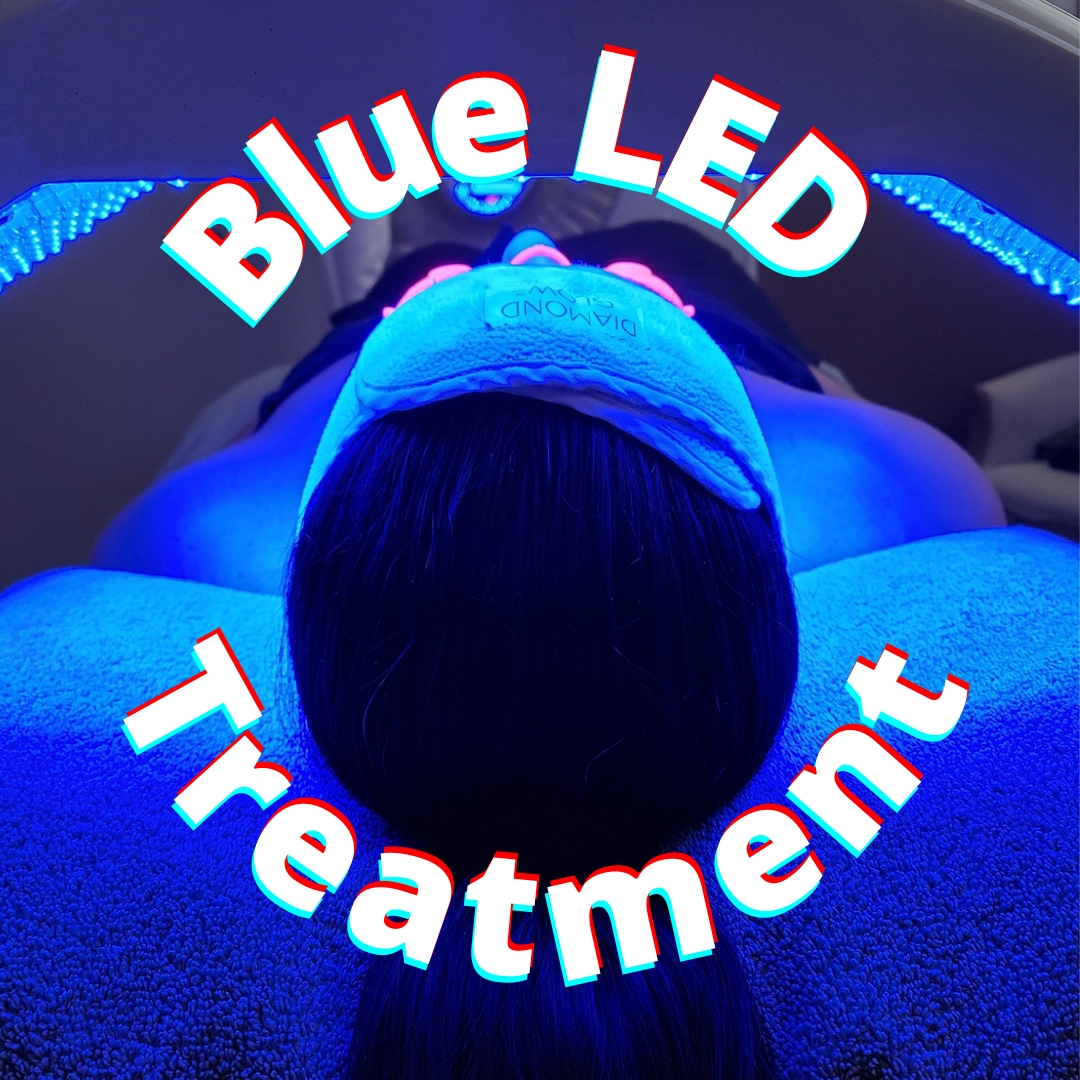 Blue LED Treatment